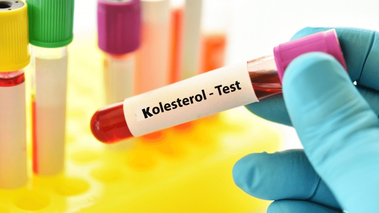 kolestrol-testi.jpg